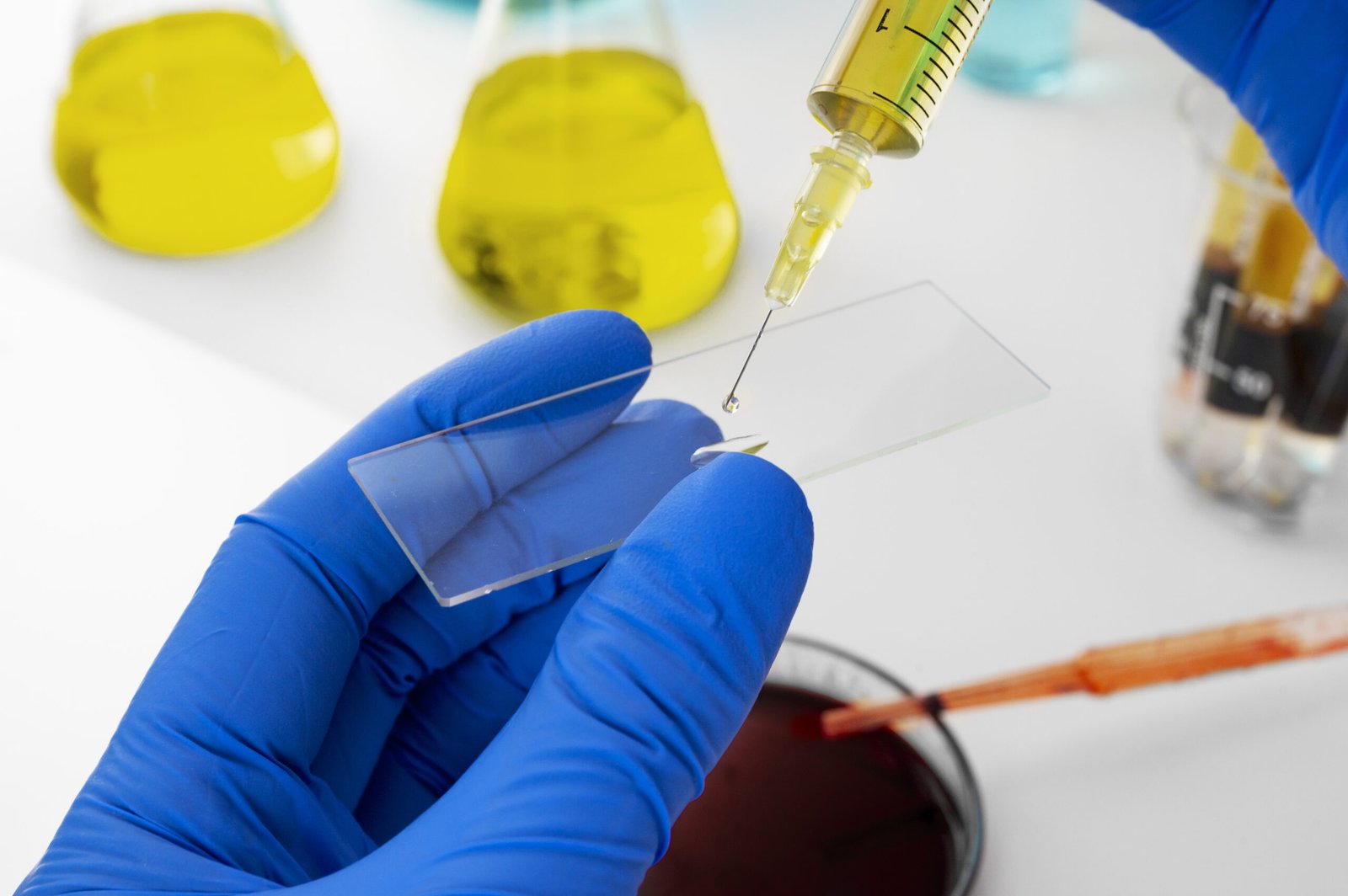 Post accident Drug testing